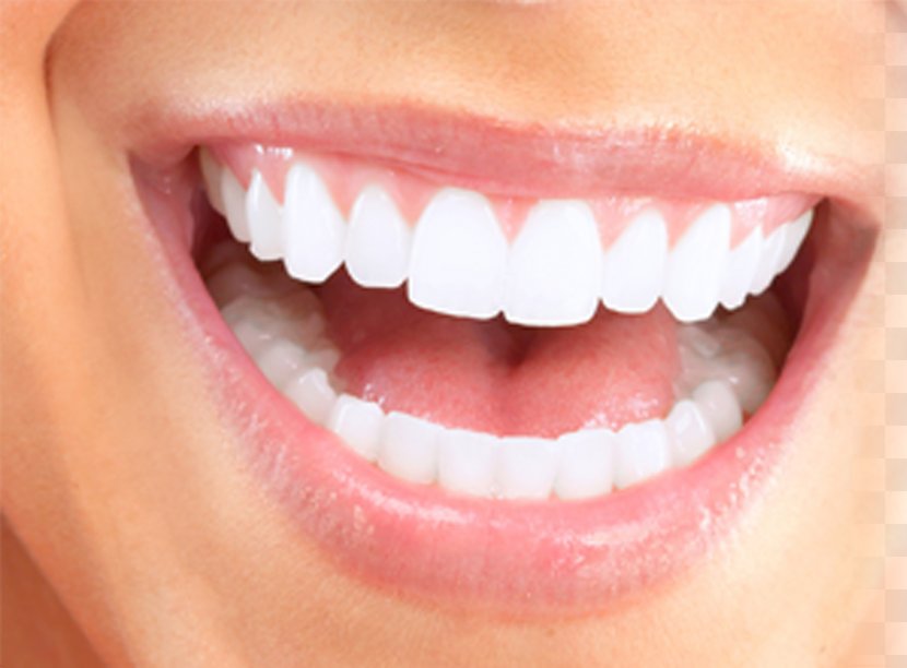 Health Cosmetic Dentistry Smile - Preventive Healthcare - Tooth Transparent PNG