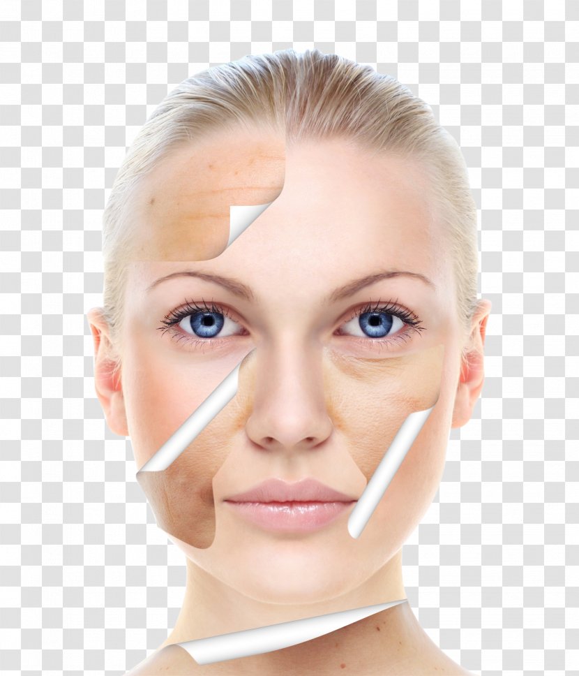 Skin Care Beauty Chemical Peel Facial - Exfoliation - Contrast Map Transparent PNG