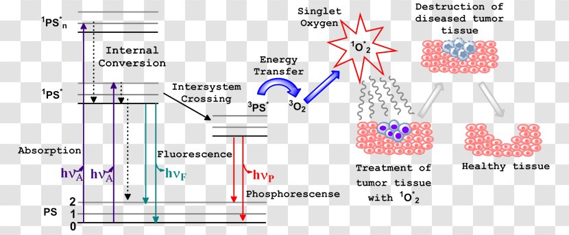 Photodynamic Therapy Singlet Oxygen Jablonski Diagram Photosensitizer - Watercolor - Cartoon Cancer Cell Transparent PNG