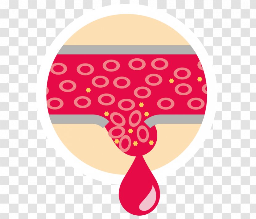 Bleeding Cancer Blood Vessel Lymphoma - Breast Transparent PNG