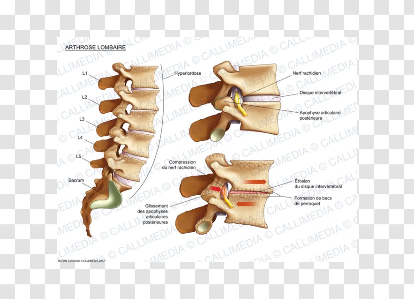 Joint Cervical Osteoarthritis Lumbar Vertebrae Process - Box Illustration Transparent PNG