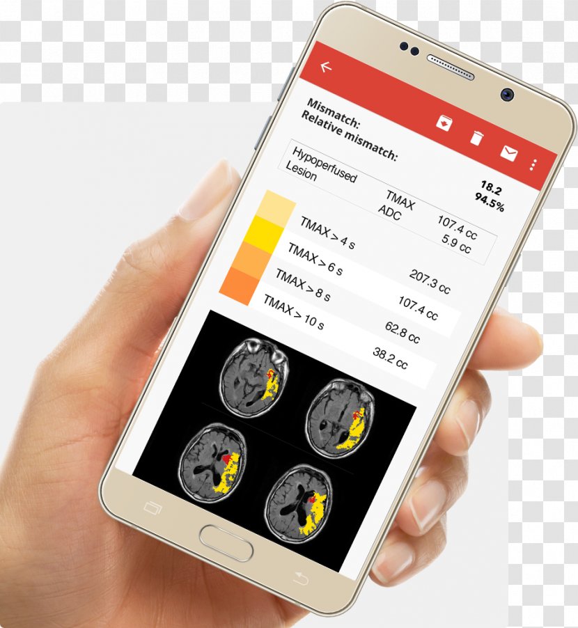 Smartphone La Ciotat Olea Medical Perfusion MRI Mobile Phones - Electronics Transparent PNG