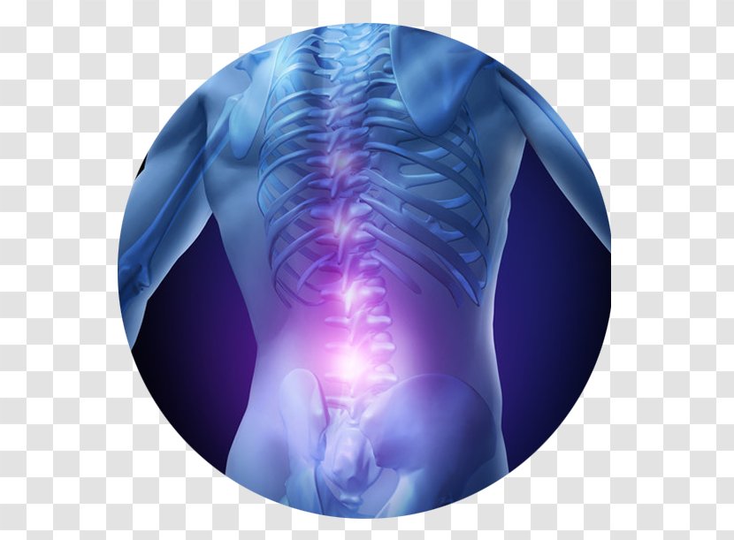 Low Back Pain Management Therapy Spinal Disc Herniation - Shoulder Transparent PNG