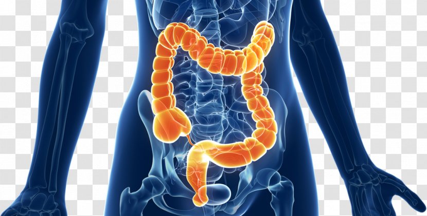 Sigmoidoscopy Large Intestine Colorectal Cancer Irritable Bowel Syndrome Gastrointestinal Tract Transparent PNG