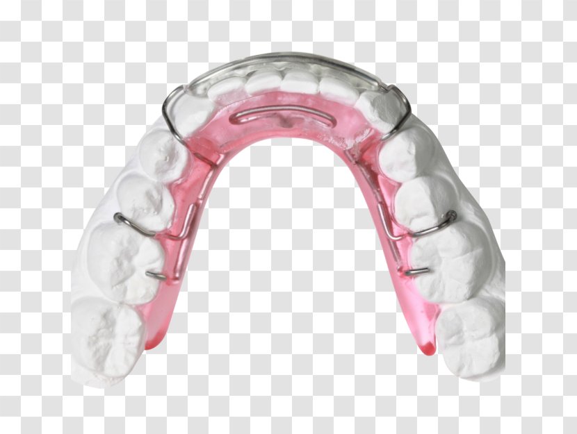 Clear Aligners Orthodontics Orthodontic Technology Jaw Bionator - Dentistry - Photo Albums Transparent PNG