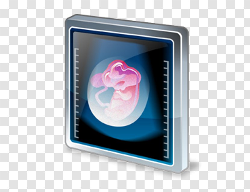 Gynaecology Medicine Yevromedlayf Multimedia - Ultrasonography - Service Transparent PNG