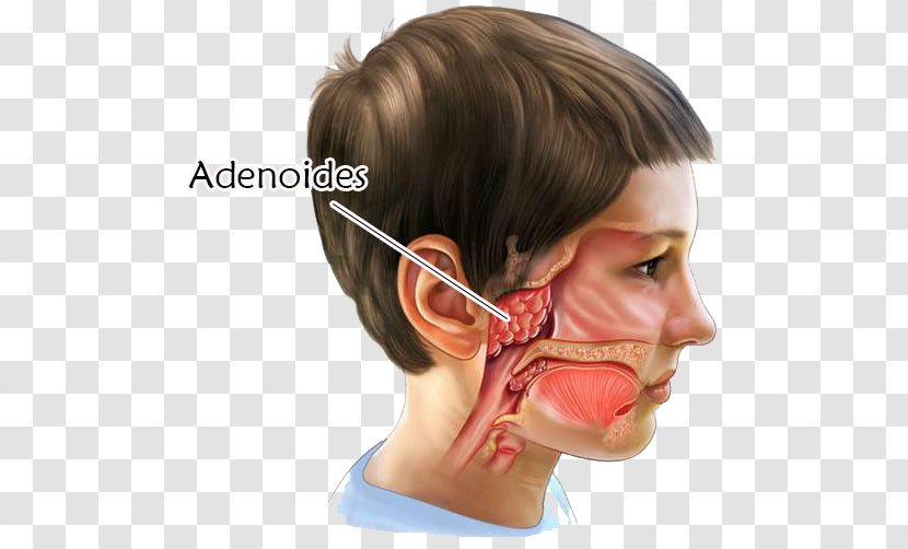 Adenoid Tonsillectomy Surgery Tonsillitis - Pharynx - Nose Transparent PNG