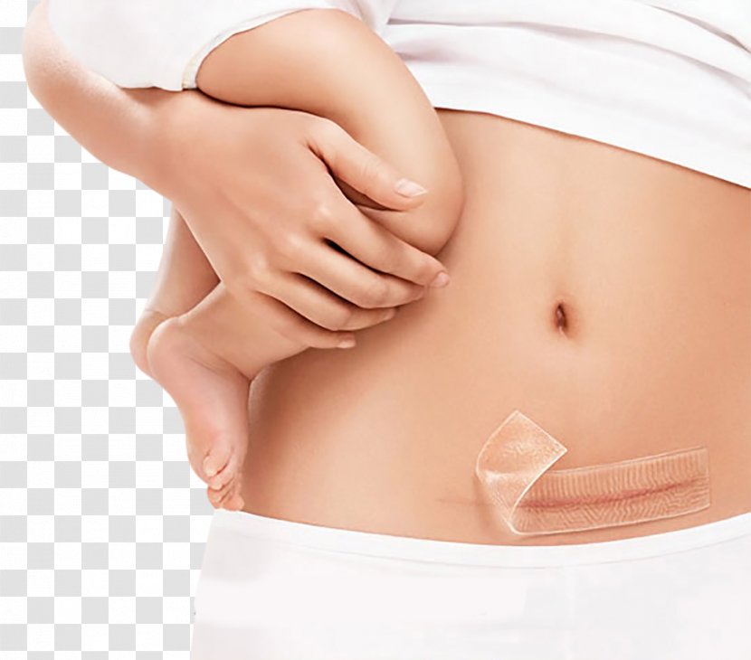 Scar Keloid Therapy Gel Silicone - Silhouette - Belly Scars Transparent PNG