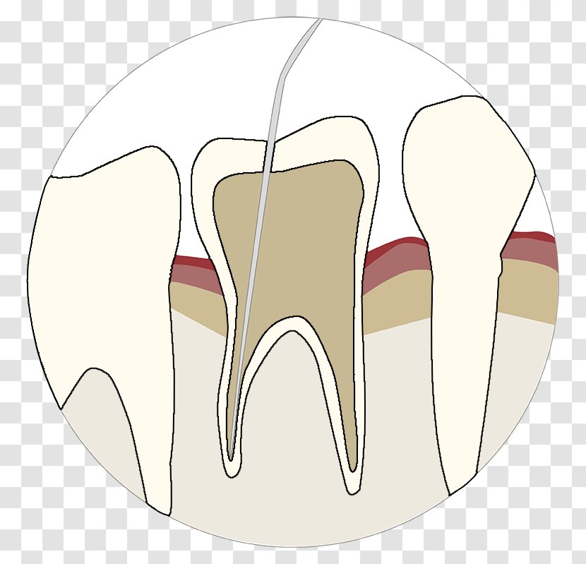 Tooth Velopex International Dentistry Air-Polishing Endodontics - Flower - Endodontic Transparent PNG