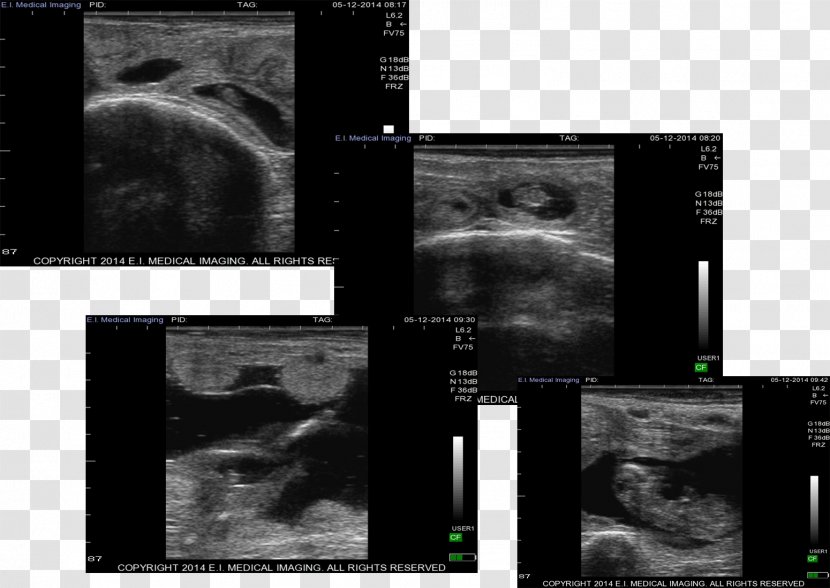 Medical Imaging Radiology Desktop Wallpaper Screenshot Medicine - Computer Transparent PNG