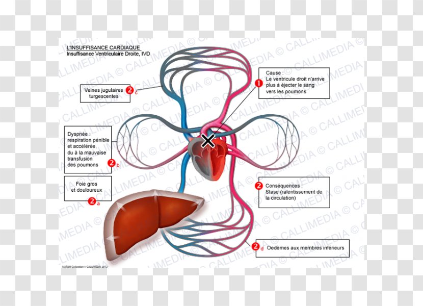 Heart Failure Right Ventricle Lung Electrocardiography - Tree - Flower Transparent PNG