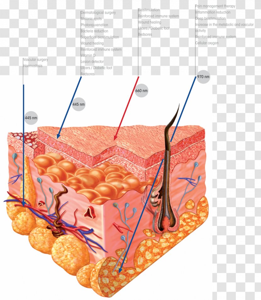 Atopic Dermatitis Medicine Light Therapy Atopy - Cuisine - Derma Sciences Transparent PNG