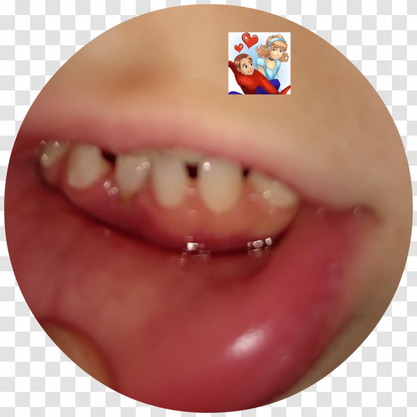 Chin Cheek Mouth Jaw Lip - Closeup - Baby Teeth Transparent PNG