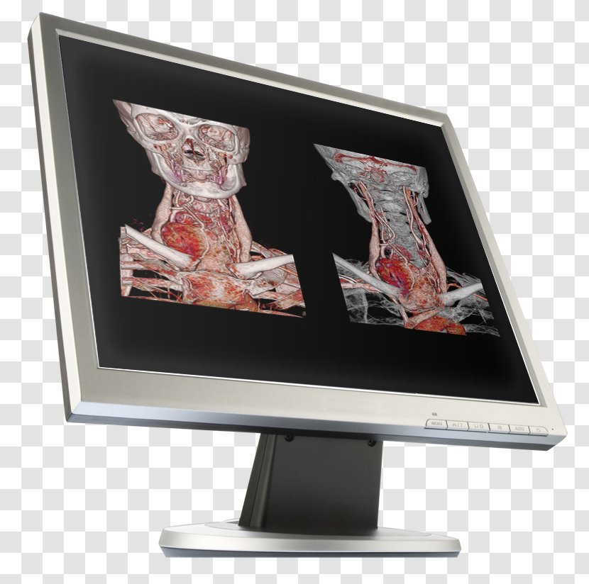 Computer Monitors Workflow Image Computed Tomography Canon Medical Systems Corporation - Scanner - Semar Transparent PNG