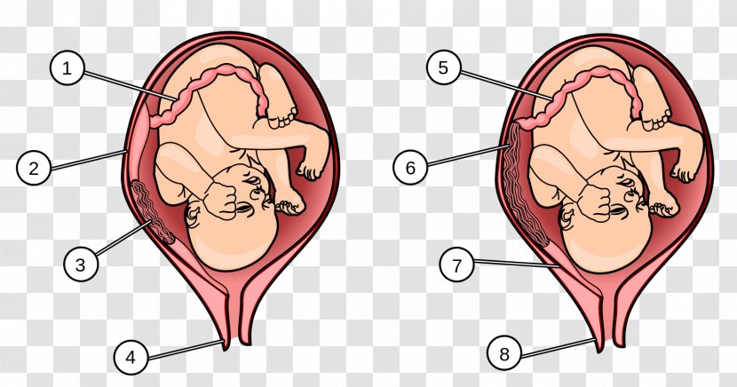 Placenta Praevia Human Fetus Uterus - Tree - Part Of Female Reproductive System Transparent PNG