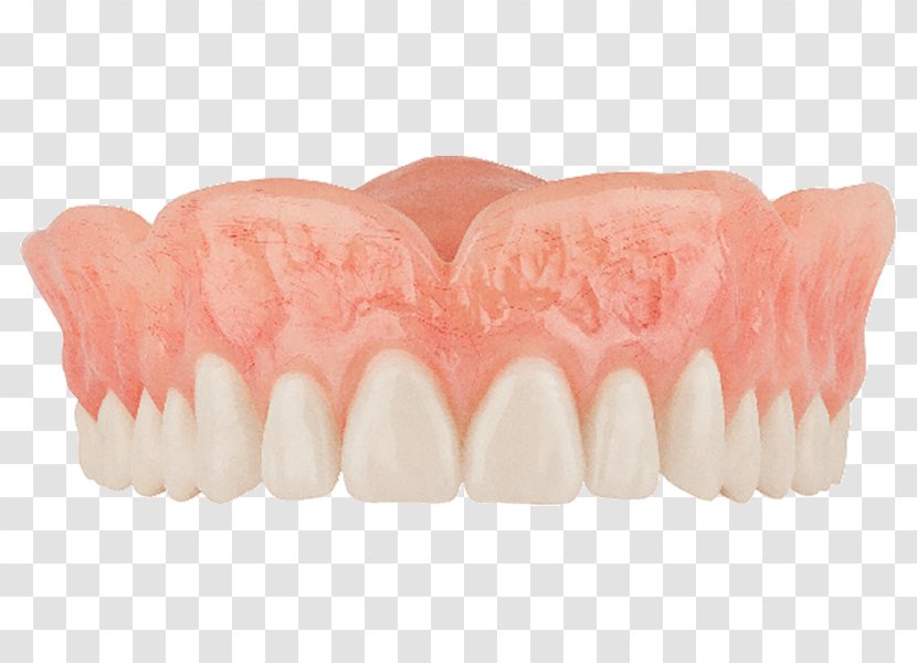 Tooth Dentures Dentistry Removable Partial Denture - Health Care - High Grade Shading Transparent PNG