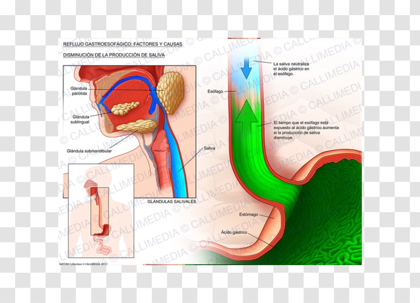 Gastroesophageal Reflux Disease Esophagus Saliva Gastro- Cough - Heart - Silhouette Transparent PNG