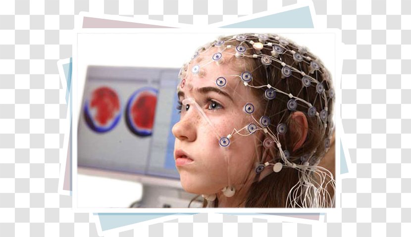 Electroencephalography Epilepsy Meningioma Disease Symptom - Chin - Ana Sayfa Transparent PNG