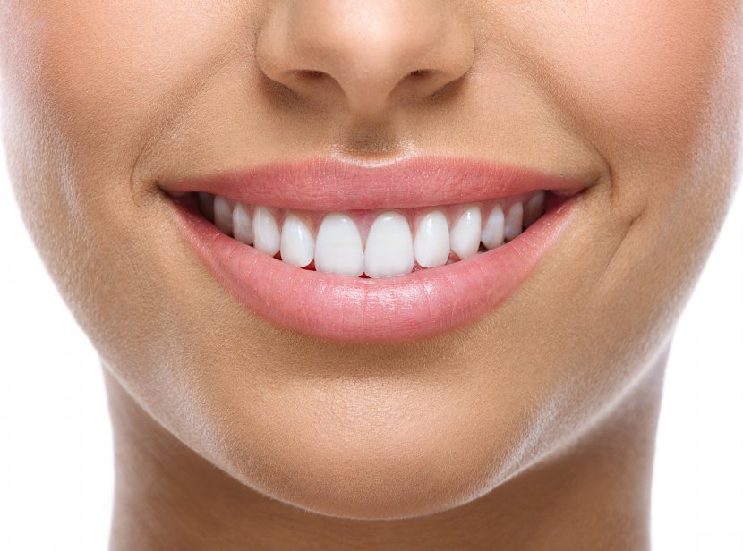 Tooth Whitening Cosmetic Dentistry Smile - Facial Expression - Teeth Transparent PNG