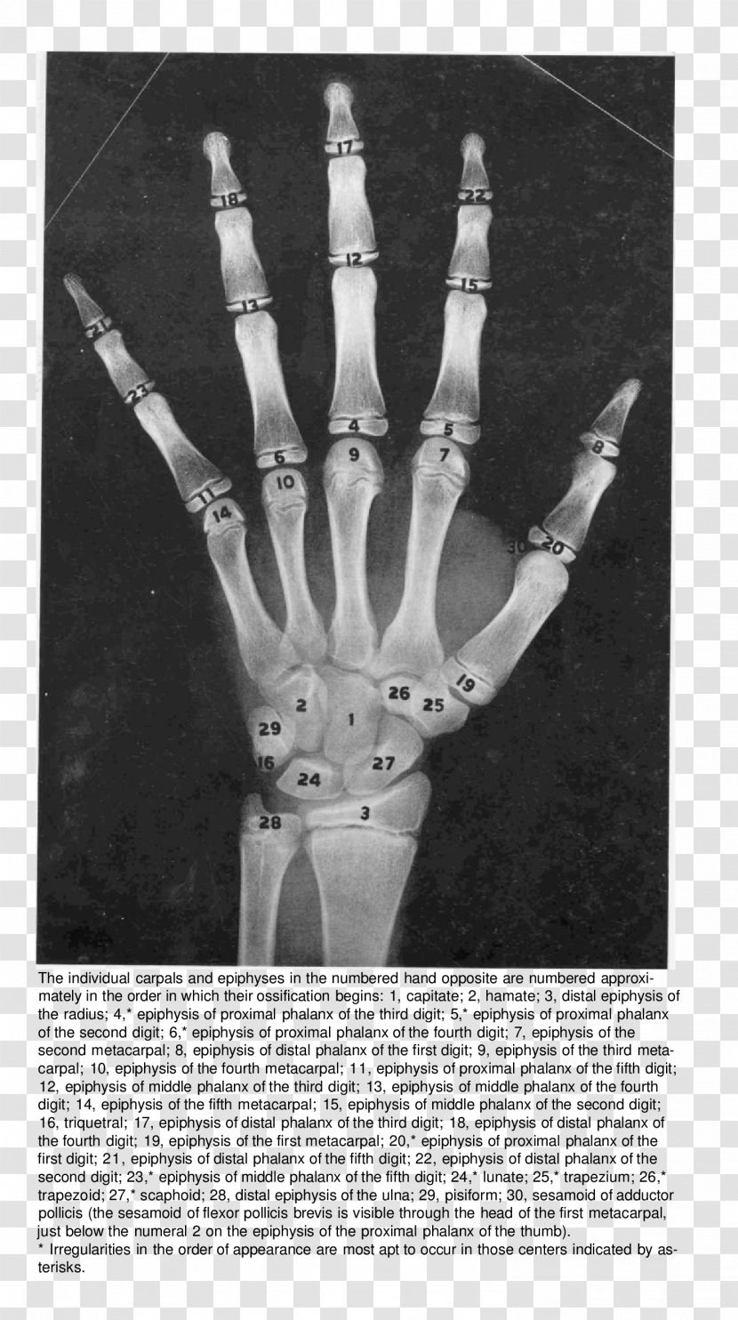 Finger Bone Hand Radiography Anatomy Transparent PNG