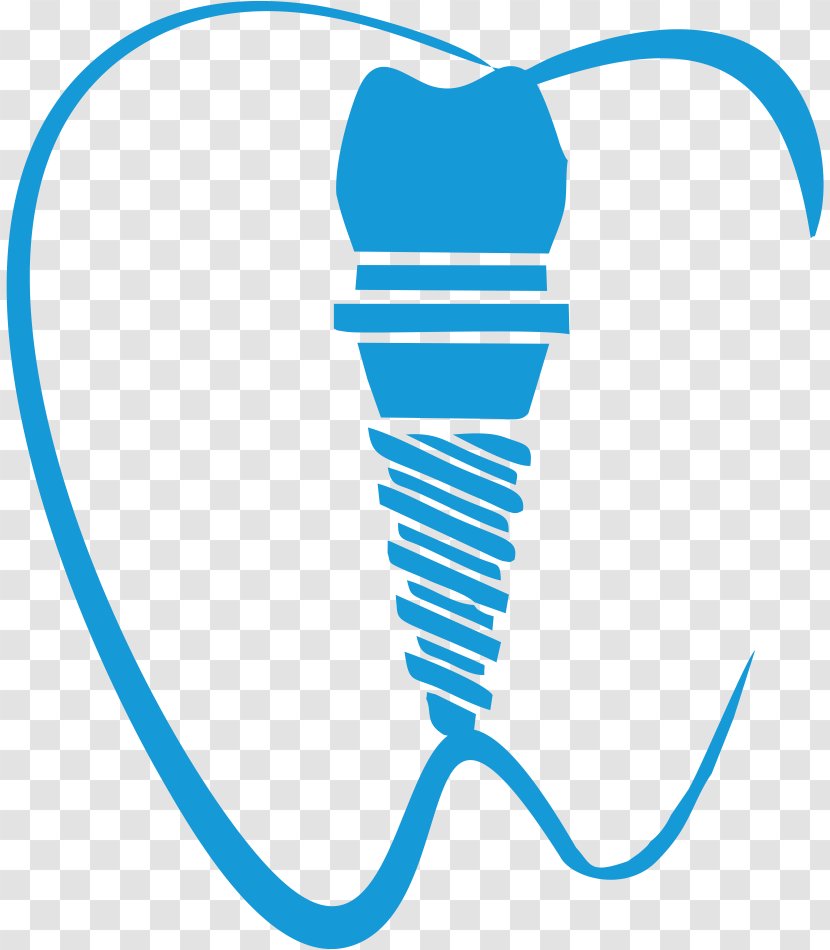 Dental Implant Dentistry Tooth Clip Art - Area - Dente Transparent PNG