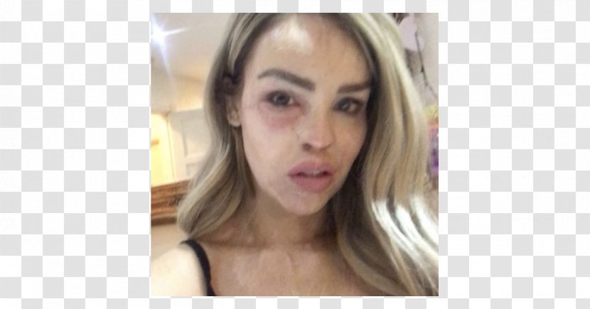 Katie Piper Acid Throwing Model Disfigurement - Frame Transparent PNG