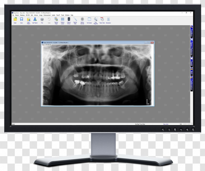 X-ray Vision Dental Radiography Dentistry - Screen Transparent PNG