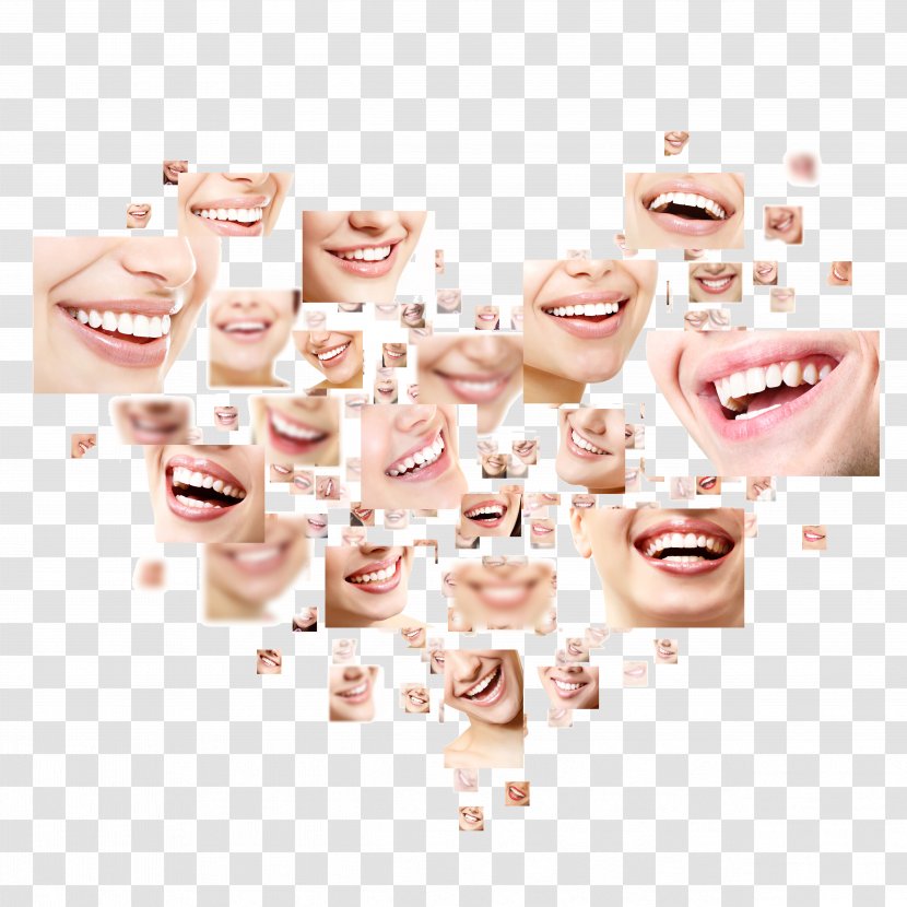 Smile Cosmetic Dentistry Tooth - Human - Creative Teeth Transparent PNG