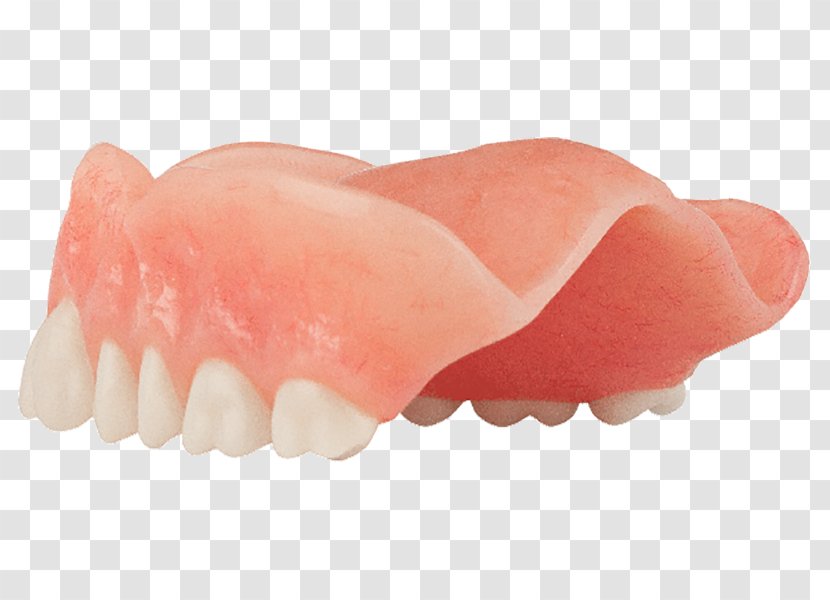Tooth Dentures Dentistry All-on-4 Dental Implant - Peach - Aspen Transparent PNG