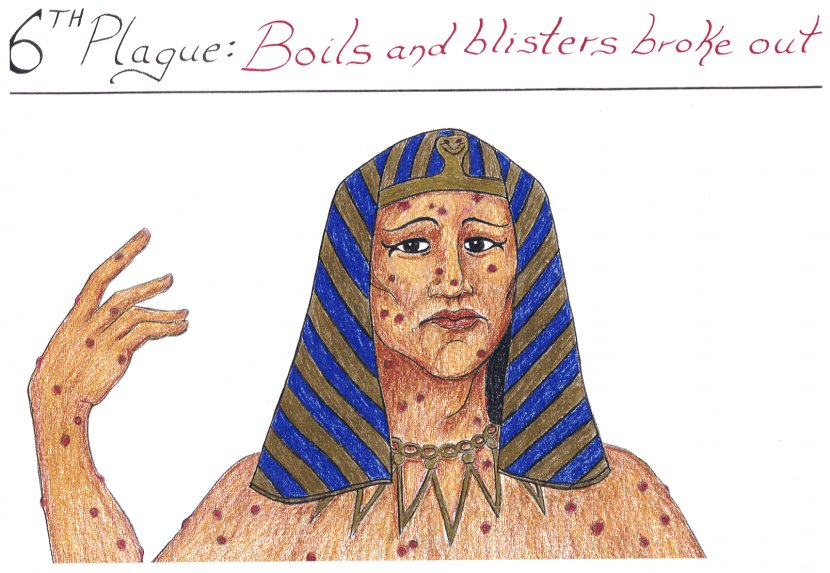 Plagues Of Egypt Bible Book Exodus Boil Leviticus - Boils Cliparts Transparent PNG