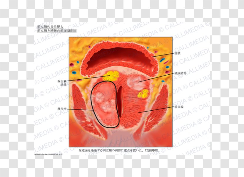 Prostate Imaging Anatomy Magnetic Resonance Urinary Bladder - Tree - Bexiga Transparent PNG