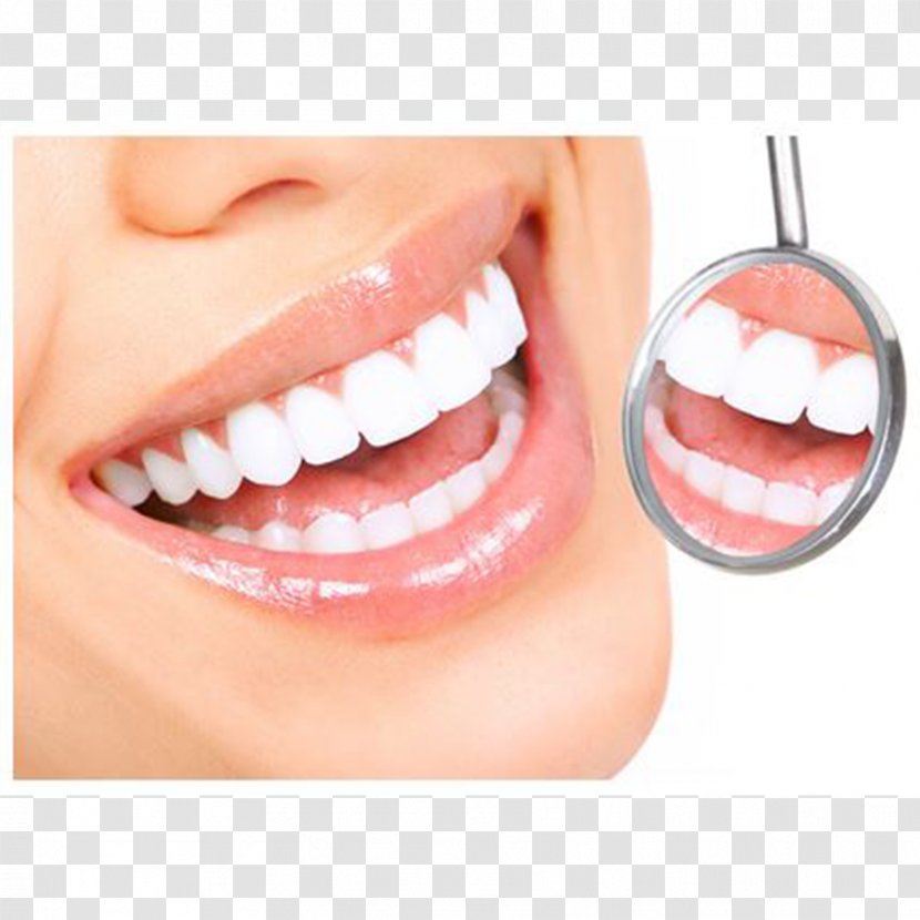 Cosmetic Dentistry Periodontal Disease Dental Surgery Transparent PNG