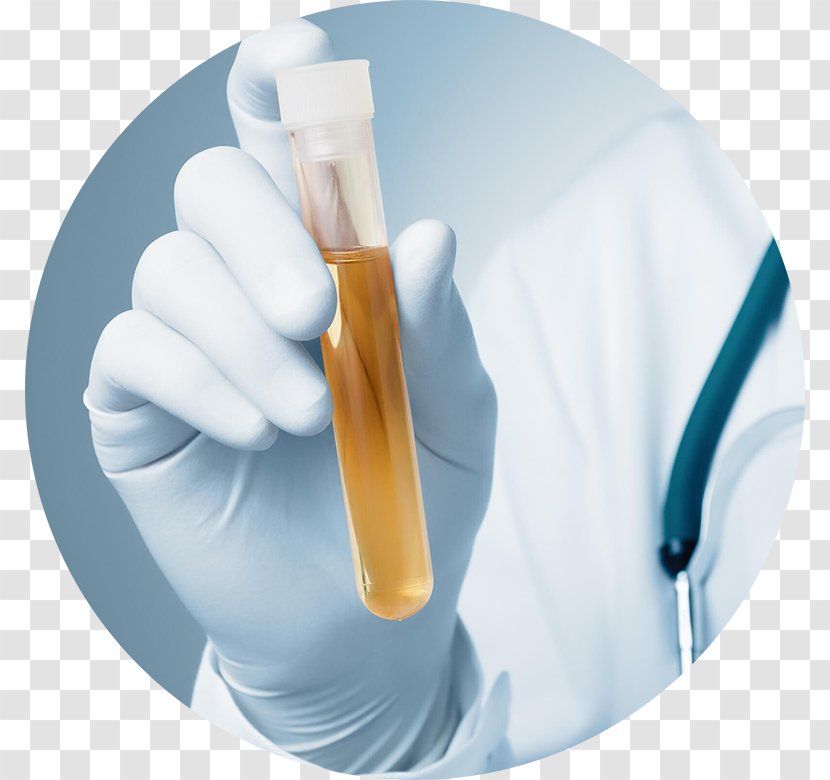 Clinical Urine Tests Urinary Tract Infection Bladder Cancer Olfaction - Drug Transparent PNG