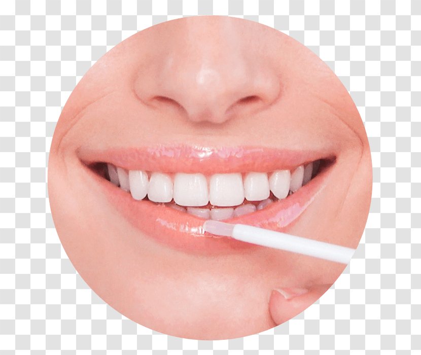 Frauen-Bundesliga Cosmetics Surgery Lip Mouth - Dentist - High-end Decadent Strokes Transparent PNG