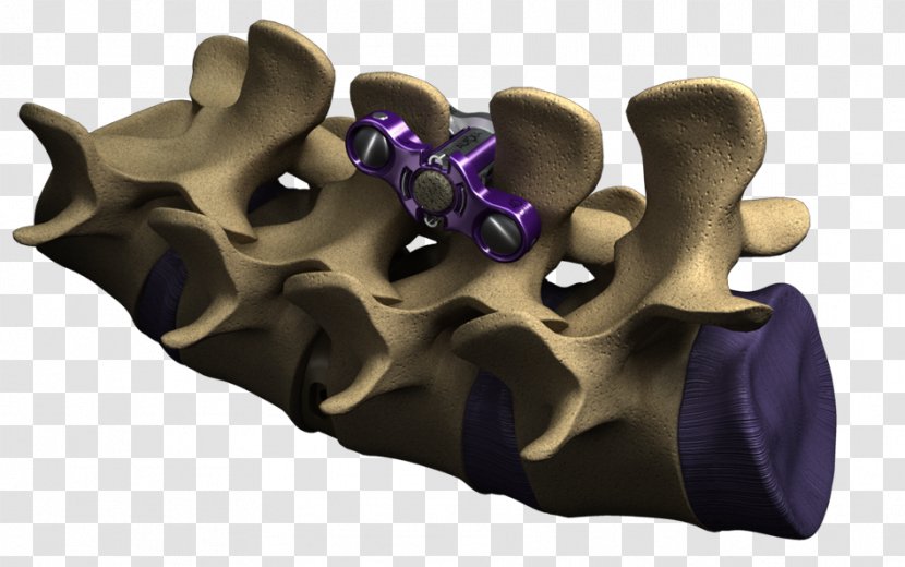 Interspinous Ligament Vertebral Column Spinal Fusion Surgery Lumbar Vertebrae - Purple - Process Transparent PNG