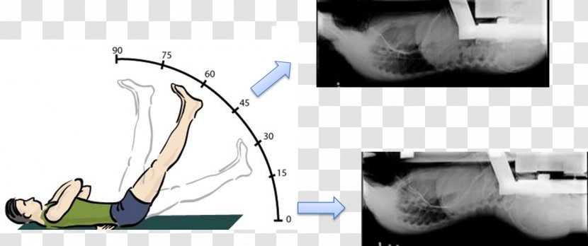 Range Of Motion Facet Joint Low Back Pain - Tree - Fibrous Transparent PNG