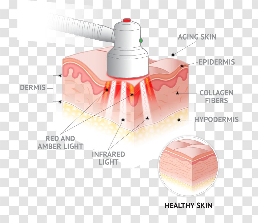 Light Therapy Quasar MD BLUE Skin Care Wrinkle - Lightemitting Diode Transparent PNG