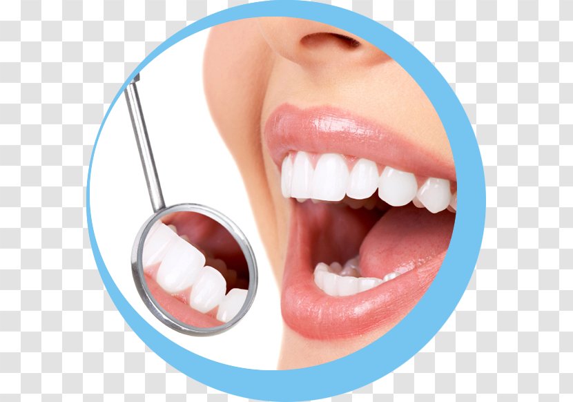 Cosmetic Dentistry Dental Restoration Tooth Decay Transparent PNG