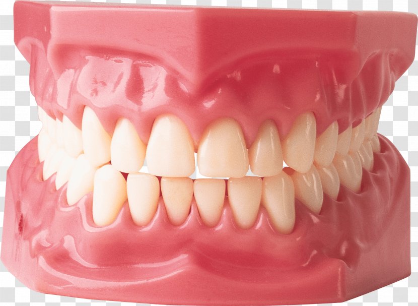 Gums Dentistry Human Tooth Dentures - Veneer - Teeth Image Transparent PNG