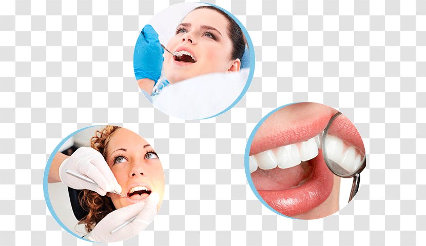 Dentistry Tooth Whitening Dental Implant Endodontic Therapy - Face - Cosmetic Transparent PNG