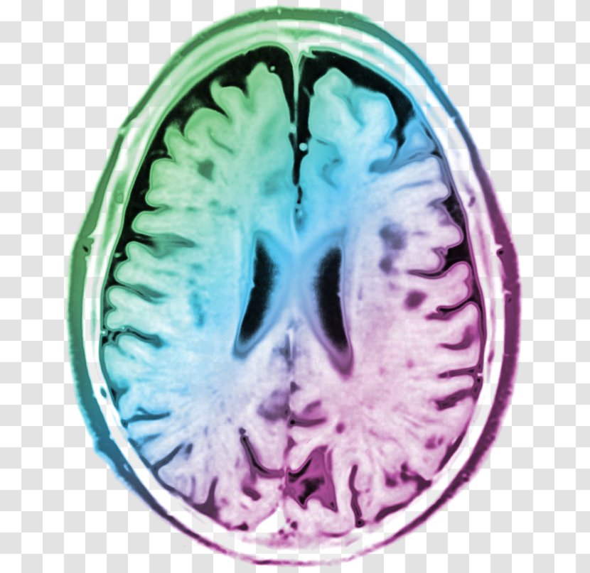 Computed Tomography Brain Organism - Silhouette - Peace Of Mind Transparent PNG