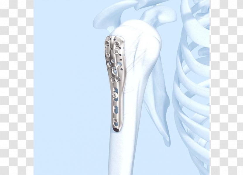Shoulder Humerus Fracture Bone Diaphysis - Ring Transparent PNG
