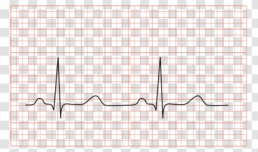 Electrocardiography Heart QRS Complex Sinus Rhythm Sinoatrial Node - Flower - Strips Transparent PNG