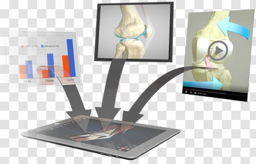 Knee Homo Sapiens Anatomy Effigos AG - Patella Transparent PNG