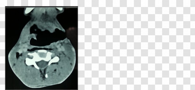 Radiology Medical Imaging X-ray Bone Medicine - Neck Bloodstain Transparent PNG