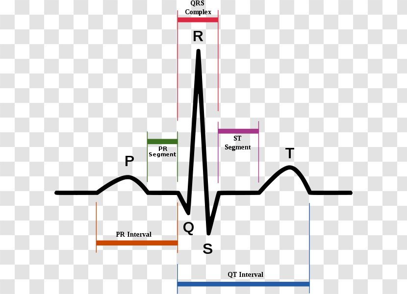 QT Interval Long Syndrome PR T Wave QRS Complex - Area - Electrocardiogram Transparent PNG