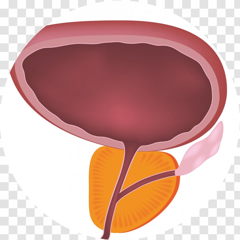 Benign Prostatic Hyperplasia Prostate Lower Urinary Tract Symptoms Benignity - Medicine Transparent PNG