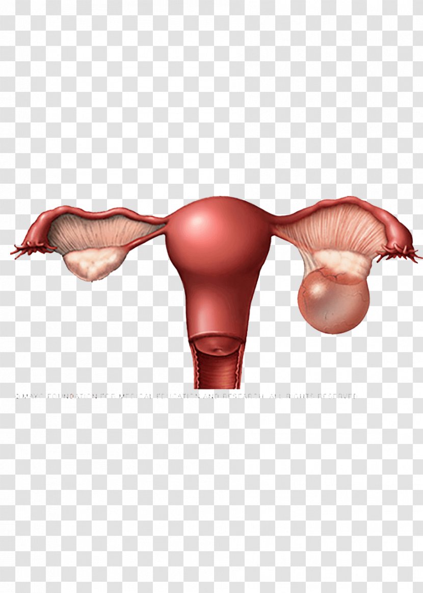 Ovarian Cyst Follicular Of Ovary Dermoid - Egg Cell - Shree Ram Transparent PNG