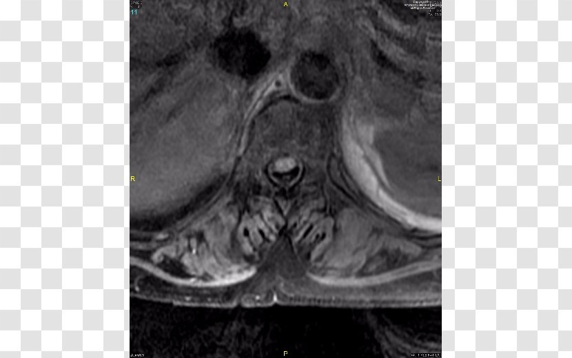 Medical Imaging Stock Photography Snout Close-up - Medicine - November 16 Transparent PNG