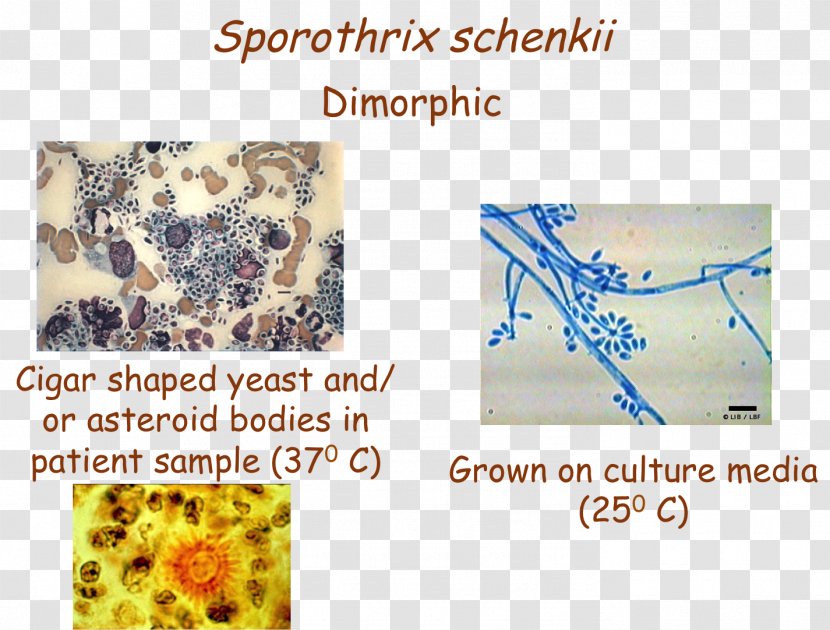 Sporothrix Schenckii Organism - Text - USMLE Step 3 Transparent PNG